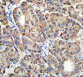 Anti-TIRAP Antibody