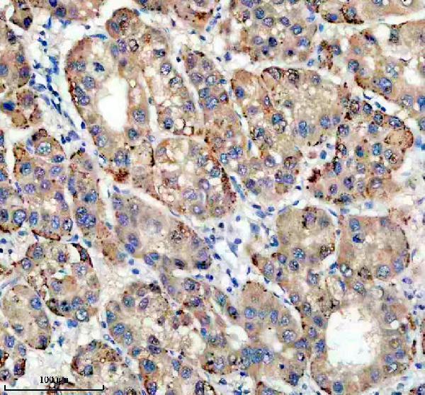 Anti-TIRAP Antibody
