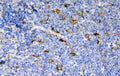 Anti-CCR6  Antibody