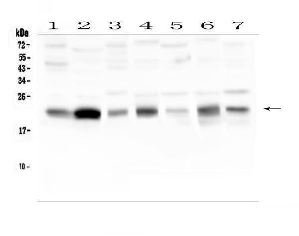 Anti-Caveolin-3/CAV3 Antibody Picoband®