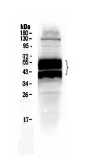 Anti-uPA Receptor/PLAUR Antibody Picoband®
