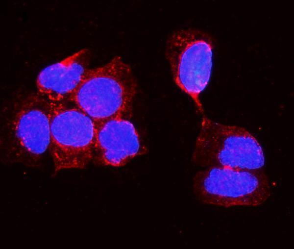Anti-Alkaline phosphatase/ALPL Antibody Picoband®