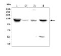 Anti-Natriuretic Peptide Receptor A/GC-A/NPR1 Picoband® Antibody