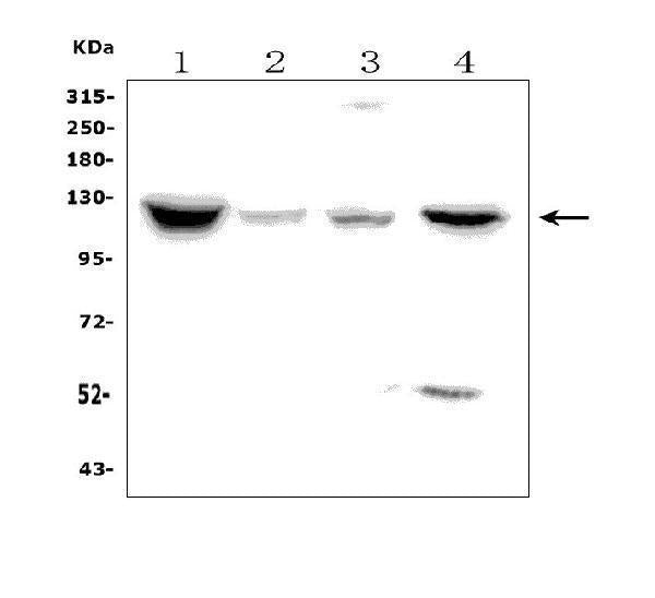 Anti-Natriuretic Peptide Receptor A/GC-A/NPR1 Picoband® Antibody