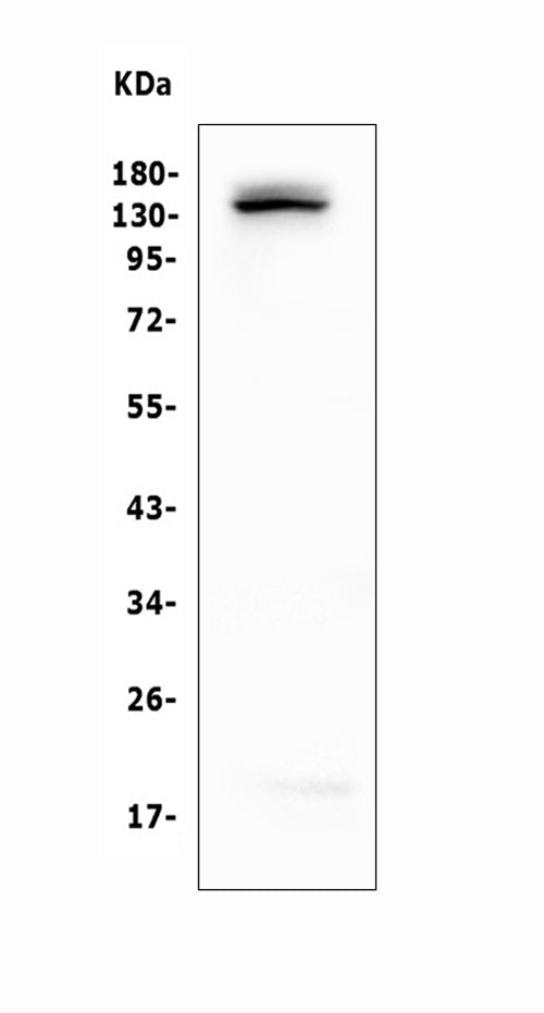 Anti-LATS1 Antibody Picoband®