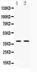 Anti-Doublecortin/DCX Antibody Picoband®