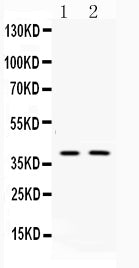 Anti-Doublecortin/DCX Antibody Picoband®