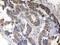 Anti-RANK/TNFRSF11A Antibody Picoband®