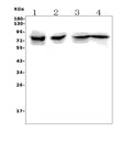 Anti-RANK/Tnfrsf11a Picoband® Antibody