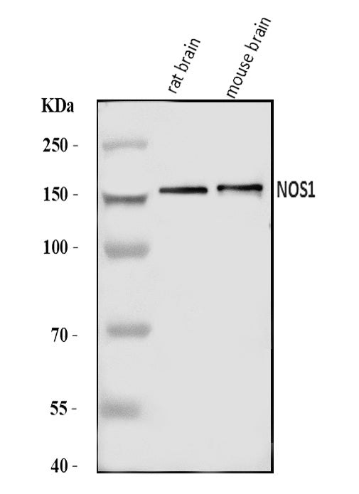 Anti-nNOS (neuronal)/NOS1 Antibody Picoband®