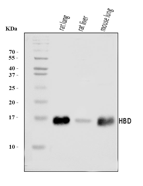 Anti-HBD Antibody Picoband®