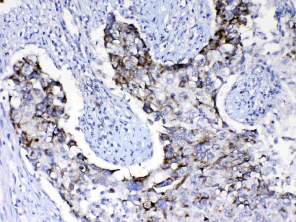 Anti-PI3 Kinase p110 beta/PIK3CB Antibody Picoband®