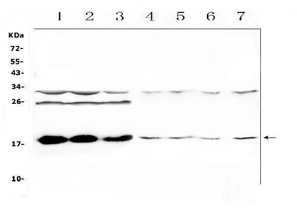 Anti-TSLP Antibody Picoband®