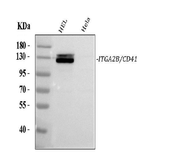 Anti-CD41/Integrin Alpha 2B/ITGA2B Antibody Picoband®