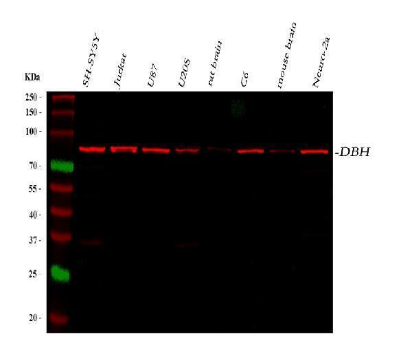 Anti-Dopamine beta Hydroxylase/DBH Antibody Picoband®