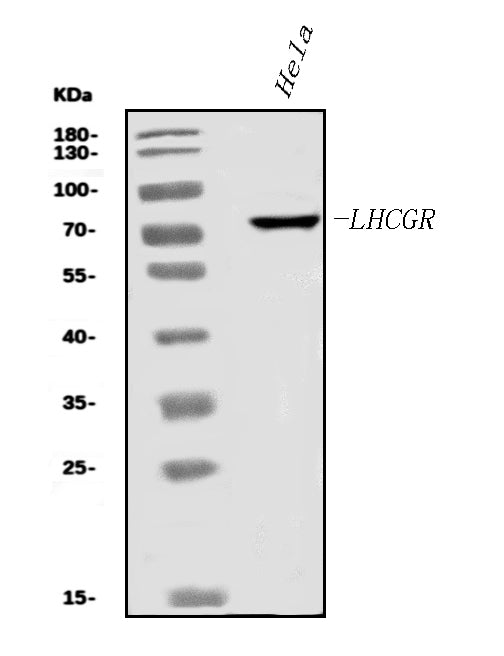 Anti-hCG receptor/LHR/LHCGR Antibody Picoband®
