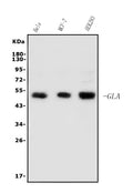 Anti-Galactosidase alpha/Gla Antibody Picoband®