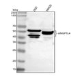Anti-ANGPTL4 Antibody Picoband®