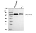 Anti-Angiopoietin-like 4/ANGPTL4 Antibody Picoband®