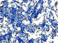 Anti-Cd27 Antibody