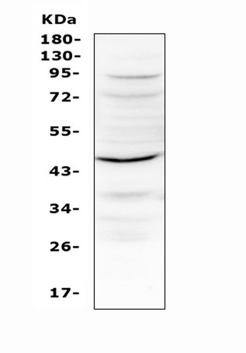 Anti-IL12B Antibody Picoband®