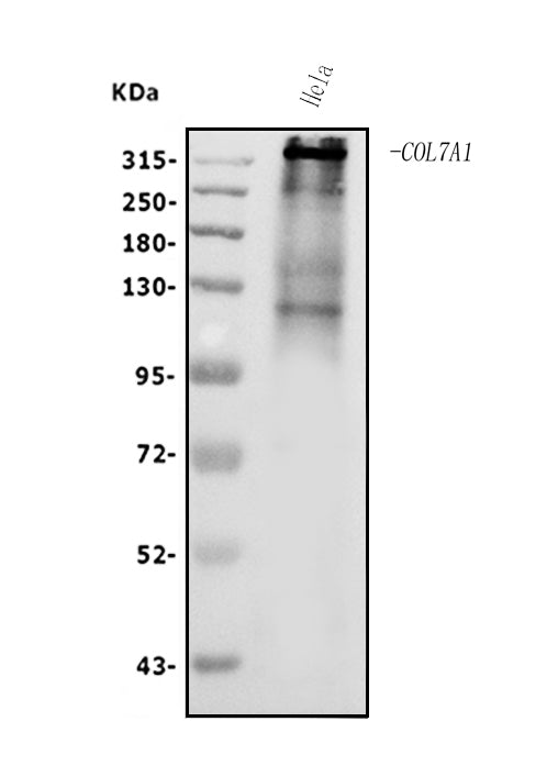 Anti-Collagen VII/COL7A1 Antibody Picoband®