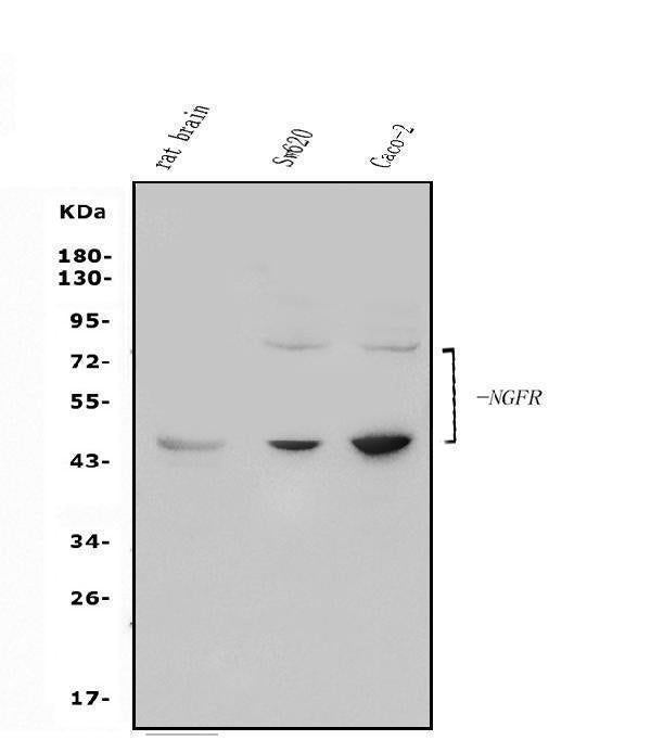 Anti-p75 NGF Receptor/NGFR Antibody Picoband®