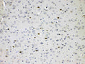 Anti-Choline Acetyltransferase/CHAT Antibody Picoband®