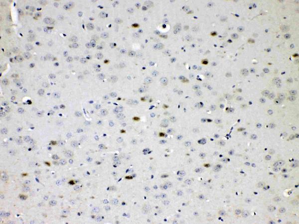 Anti-Choline Acetyltransferase/CHAT Antibody Picoband®