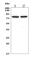 Anti-Choline Acetyltransferase/CHAT Antibody Picoband®