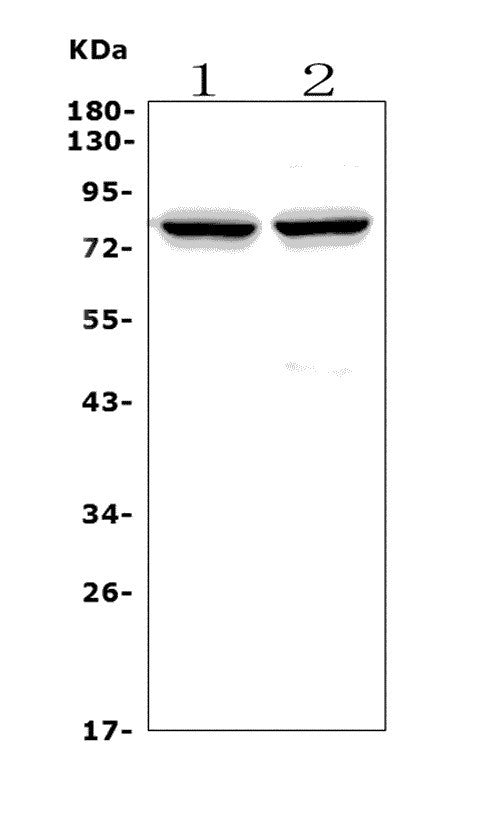 Anti-Choline Acetyltransferase/CHAT Antibody Picoband®