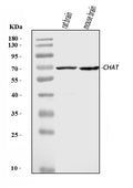 Anti-Choline Acetyltransferase/CHAT Antibody Picoband®