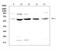 Anti-Steroid sulfatase/STS Antibody Picoband®