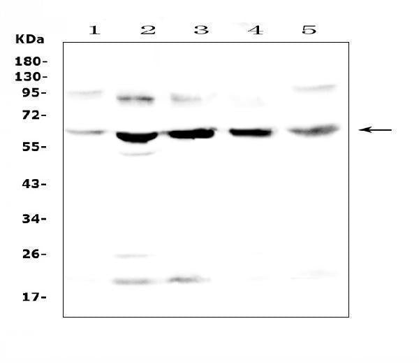 Anti-Steroid sulfatase/STS Antibody Picoband®