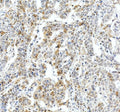 Anti-Fibrinogen beta chain/FGB Antibody Picoband®