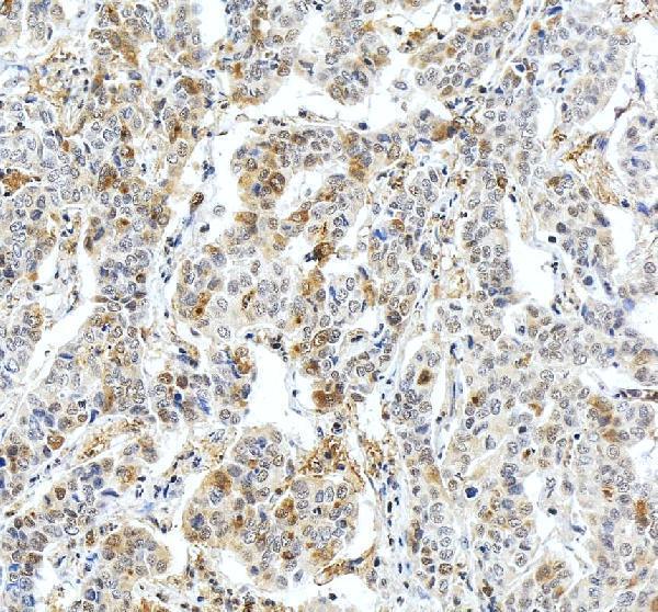 Anti-Fibrinogen beta chain/FGB Antibody Picoband®