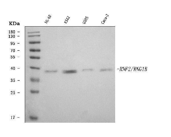 Anti-RING2/RING1B/RNF2 Antibody Picoband®