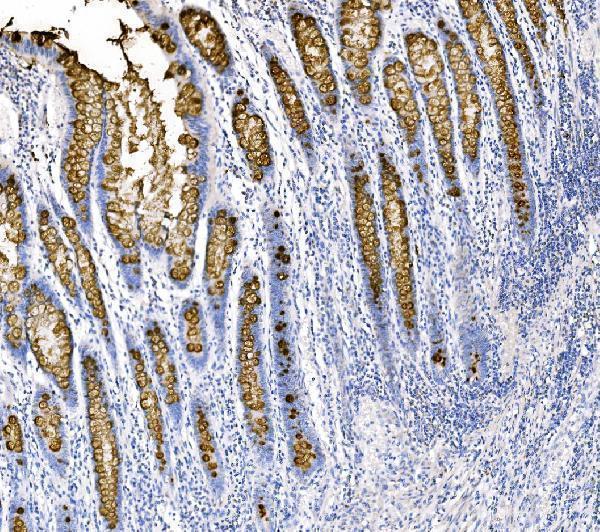 Anti-MUC2 Antibody