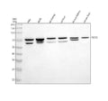 Anti-BIGH3/TGFBI Antibody Picoband®
