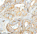 Anti-SERPING1/C1 Antibody Picoband®
