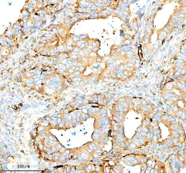 Anti-SERPING1/C1 Antibody Picoband®