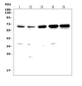 Anti-CD30/Tnfrsf8 Picoband® Antibody