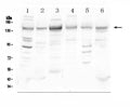 Anti-HDAC5 Antibody Picoband®