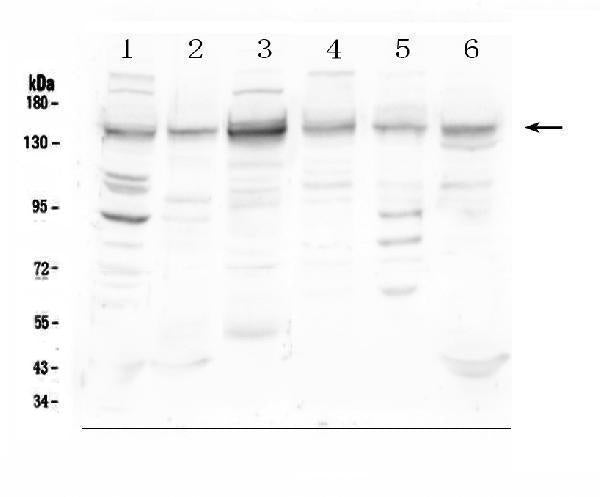 Anti-HDAC5 Antibody Picoband®