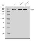 Anti-Dysferlin/DYSF Antibody Picoband®