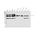 Anti-Lipoma-preferred partner LPP Antibody Picoband®