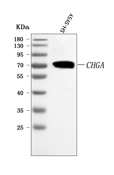 Anti-Chromogranin A/CHGA Antibody Picoband®