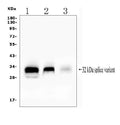 Anti-FHL Fhl1 Antibody Picoband®