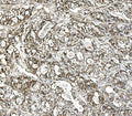 Anti-Glutaminase/GLS Antibody Picoband®