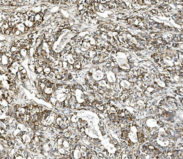 Anti-Glutaminase/GLS Antibody Picoband®
